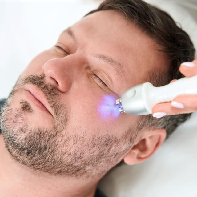 RF Full Face & Neck Firm Pack of 4 at SkinFix Pro in Longwood, FL