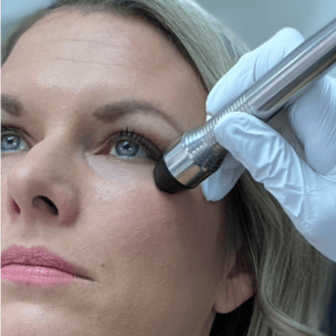 RF Eye Firming Pack of 6 at SkinFix Pro in Longwood, FL